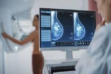 Cerca 50 milhões de brasileiras têm idade para mamografia, mas acesso ainda é desigual