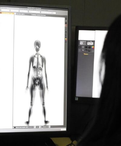 Estado terá que suspender raio-x diário em agentes, decide Justiça