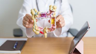 Câncer colorretal é o 3º mais comum no Brasil; diagnóstico tardio preocupa especialistas, alerta Unimed Cuiabá