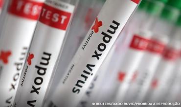 Sobe para 140 número de casos confirmados de Mpox no país, em 2026