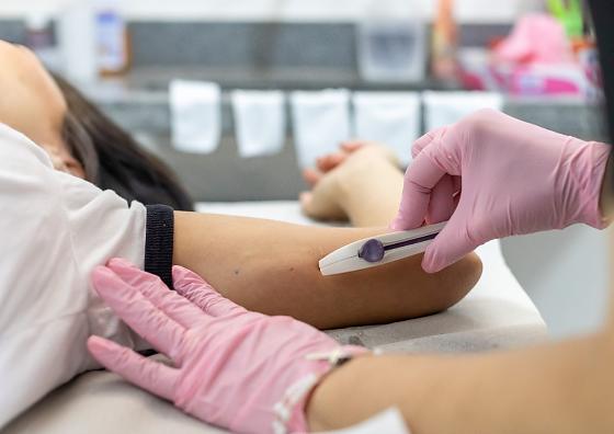 implantes de anticoncepcional 